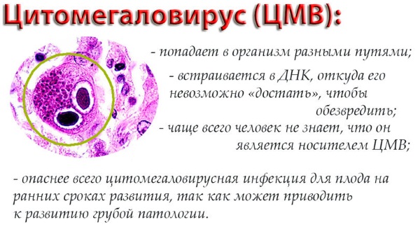 Цитомегаловирусная инфекция у детей. Симптомы и последствия, врожденная, хроническая, острая форма, лечение