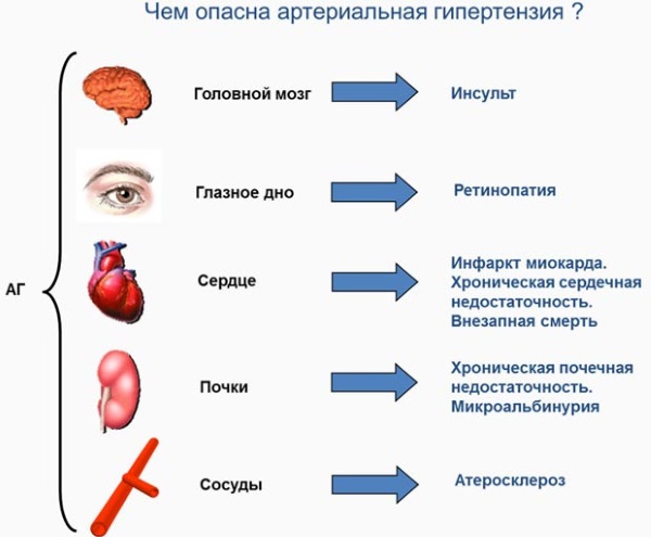 Артериальная гипертензия. Что это такое, симптомы синдрома, классификация, стадии. Лечение и клинические рекомендации, диета