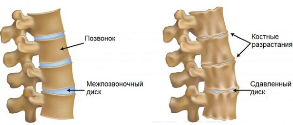 Болит шея сзади, слева, справа, сбоку. Причины, чем лечить