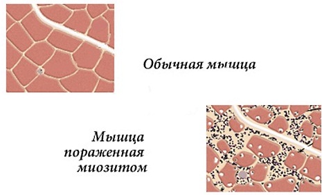 Болит шея сзади, слева, справа, сбоку. Причины, чем лечить