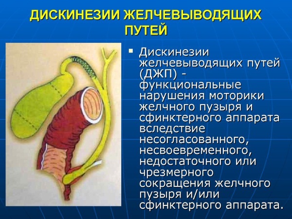 Дискинезия желчевыводящих путей. Симптомы и лечение препаратами, диета, клинические рекомендации для детей, взрослых