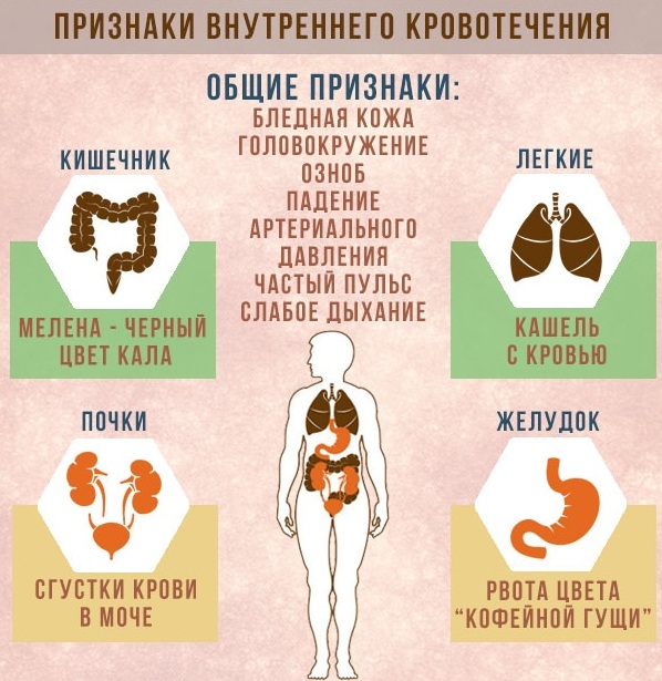 Эндоскопия желудка видеокапсульная. Что это, подготовка кишечника, алгоритм проведения. Цена процедуры