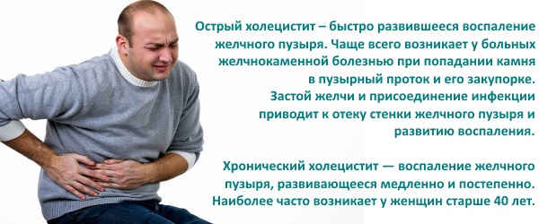 Симптомы и лечение холецистита. Народные средства, лекарства, диета, антибиотики, травы. Клинические рекомендации