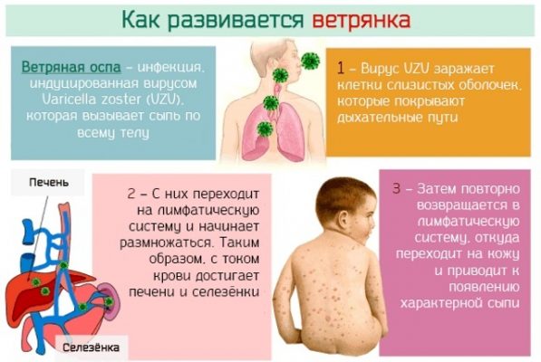 Как начинается ветрянка у детей первые признаки фото