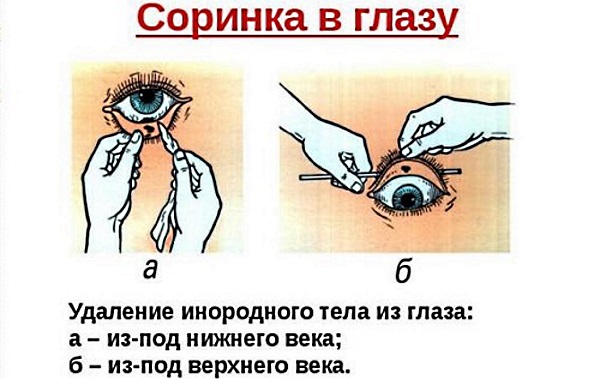 Красный глаз у ребенка. Причины с гноем и без, чешется. Лечение, промывание чаем