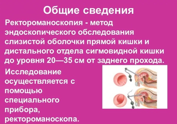 Ректороманоскопия кишечника. Что это такое, подготовка, как делается обследование у женщин, мужчин, чем лучше колоноскопии