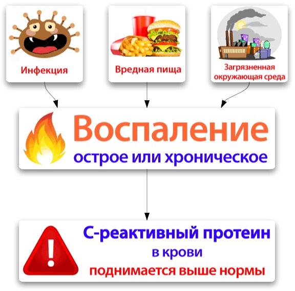 С-реактивный белок. Что это такое, норма по возрасту. Что значит повышен, отрицательный, положительный, ультрачувствительный