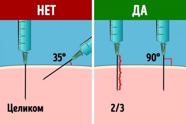 Витамины б1 б6 б12 уколы как колоть схема