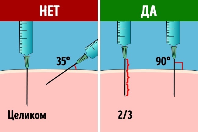 Витамин B12 в ампулах. Инструкция по применению для организма, волос, кожи. Названия, цены