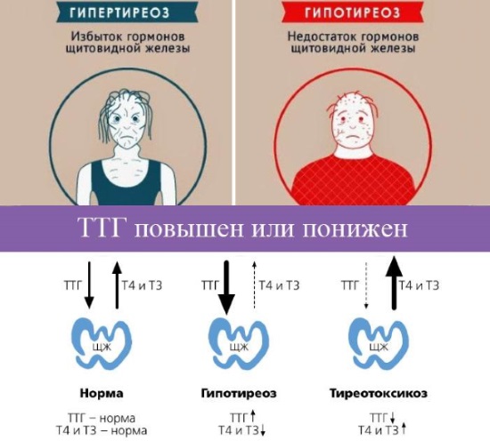 Анализ ТТГ. Что это такое, норма гормона по возрасту, что показывает, расшифровка. Подготовка, как сдавать