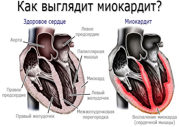 Аскорил от кашля для детей. Состав сиропа, инструкция по применению, аналоги, отзывы