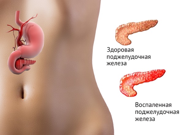 Боль в левом боку на уровне талии со спины, спереди, сбоку у женщин. Причины, лечение