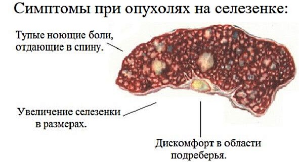 Боль в левом боку на уровне талии со спины, спереди, сбоку у женщин. Причины, лечение