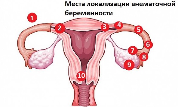 Боль в левом боку на уровне талии со спины, спереди, сбоку у женщин. Причины, лечение