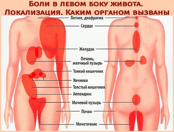 Боль в левом боку на уровне талии со спины, спереди, сбоку у женщин. Причины, лечение