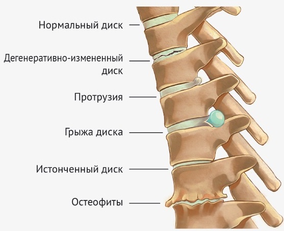 Боль в локтевом суставе правой, левой руки при сгибании и разгибании, поднятии тяжести. Причины, лечение