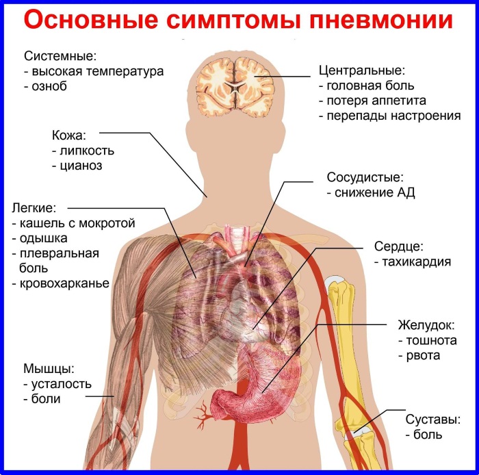 Боль в спине в области лопаток. Причины слева, справа, если отдает. Лечение, препараты