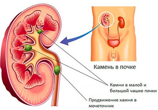 Хурма. Польза и вред для организма, противопоказания