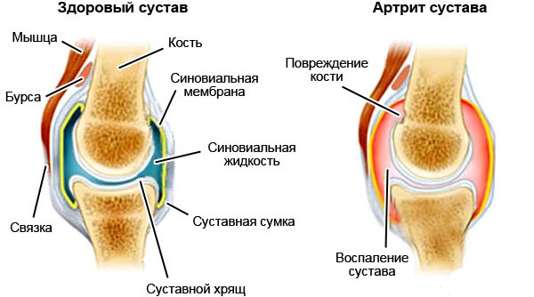 Лечебные свойства полевого хвоща, отличия от ядовитого. Применение травы в медицине и косметологии