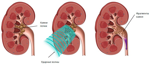 Уропрофит (Uroprofit). Инструкция по применению, цена, отзывы