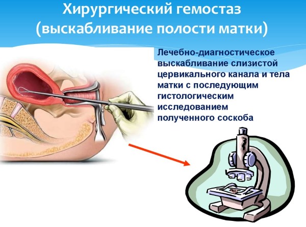 Менопаузальный синдром. Признаки, как наступает, виды, таблетки, витамины, как отсрочить