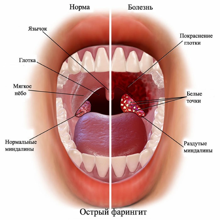 Назонекс. Инструкция по применению для детей, взрослым. Цена, аналоги