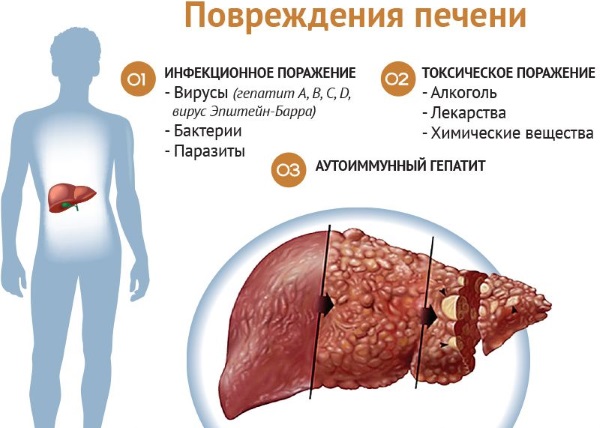 Розувастатин. Инструкция по применению. Цена, аналоги