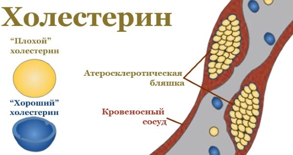 Розувастатин. Инструкция по применению. Цена, аналоги