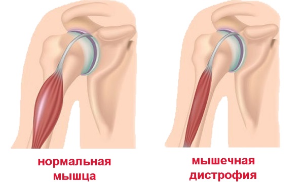 Розувастатин. Инструкция по применению. Цена, аналоги