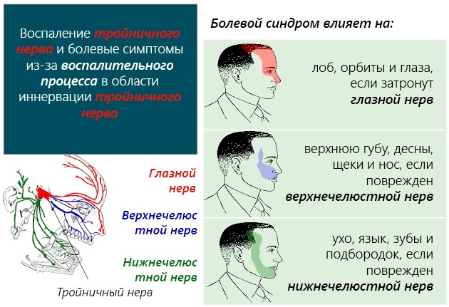 Сильные обезболивающие средства от зубной боли без рецептов. Названия, лучшие, состав, безопасность и эффективность