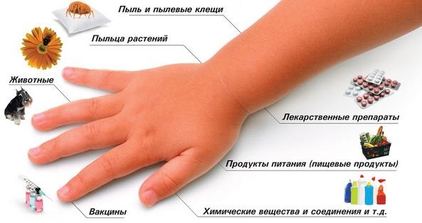 Средства от аллергии для детей. Лечение пищевой, инфекционной, вирусной, нервной, сезонной. Капли, таблетки, сиропы