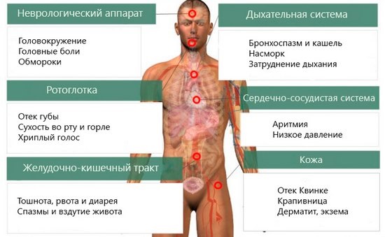 Средства от аллергии для детей. Лечение пищевой, инфекционной, вирусной, нервной, сезонной. Капли, таблетки, сиропы