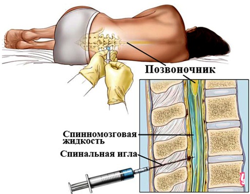 Цистоскопия мочевого пузыря у женщин, мужчин и детей. Описание процедуры, подготовка пациента, результаты обследования