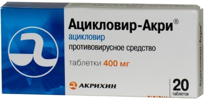 Ветрянка у взрослых. Симптомы и лечение, инкубационный период, стадии