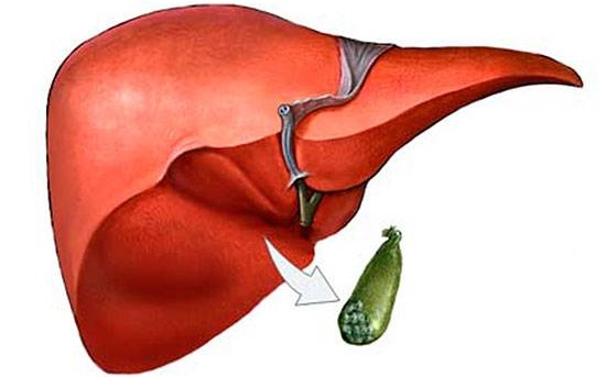 Последствия удаления желчного пузыря. Диета, физические нагрузки, что можно, какие препараты принимать