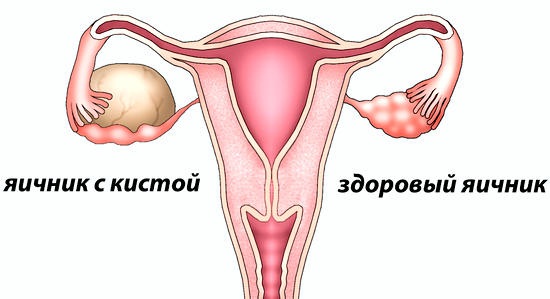 Женские гинекологические заболевания. Симптомы, выделения, зуд. Список и лечение