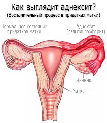 Женские гинекологические заболевания. Симптомы, выделения, зуд. Список и лечение