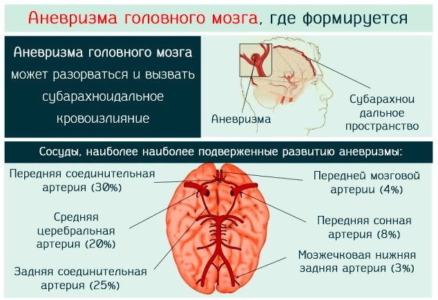 Болит голова в области затылка, шеи, висков. Причины и лечение