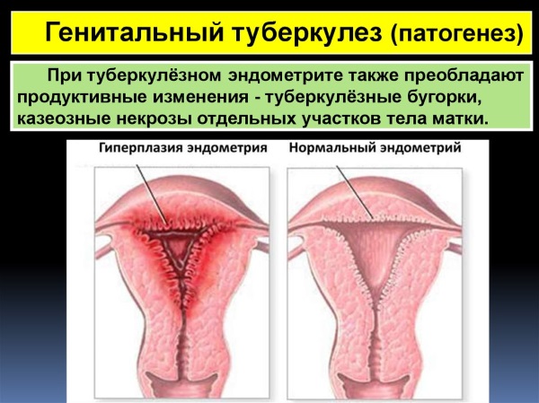 Повышенные лимфоциты в крови у женщин. Причины, норма по возрасту, лечение