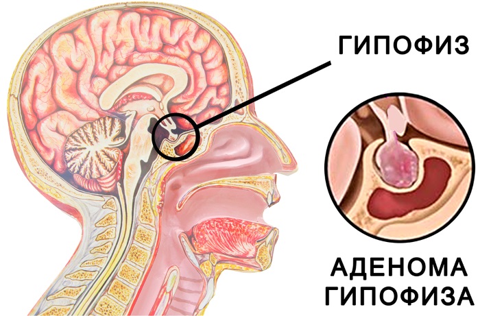 Тиреотропный гормон. Норма у женщин по возрасту, расшифровка. Что значит повышен, как лечить