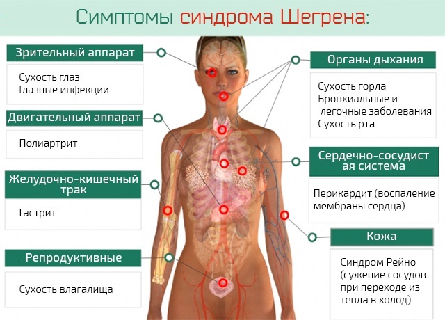 Циндол. Инструкция по применению. Цена, аналоги, отзывы