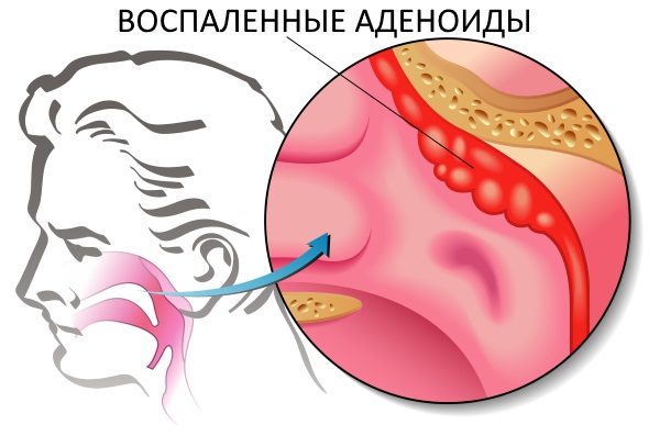 Умкалор. Инструкция по применению для детей. Цена, аналоги, отзывы