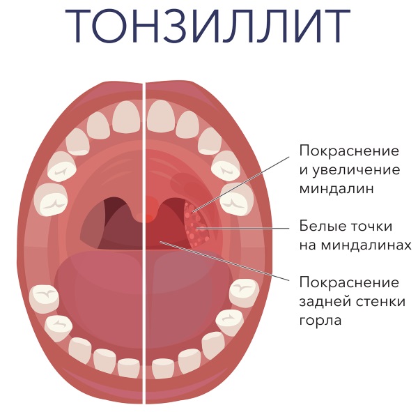 Умкалор. Инструкция по применению для детей. Цена, аналоги, отзывы