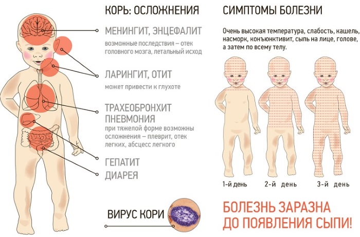 Вирусная экзантема у детей. Признаки, симптомы, фото и лечение