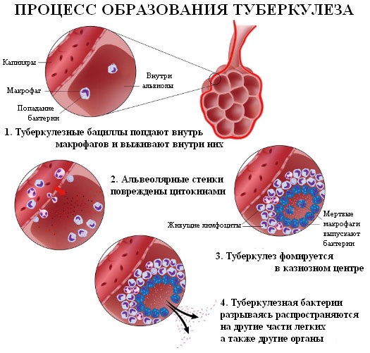 Панлейкопения лечение схема