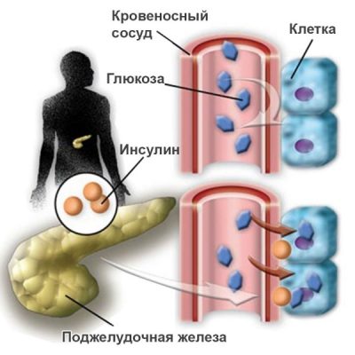 Запах ацетона от стула