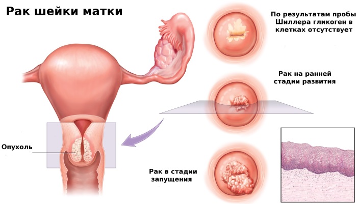 Женские болезни по гинекологии. Названия, симптомы и лечение, признаки