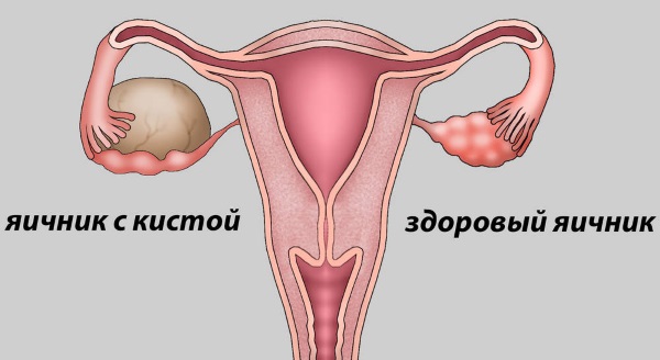 Женские болезни по гинекологии. Названия, симптомы и лечение, признаки