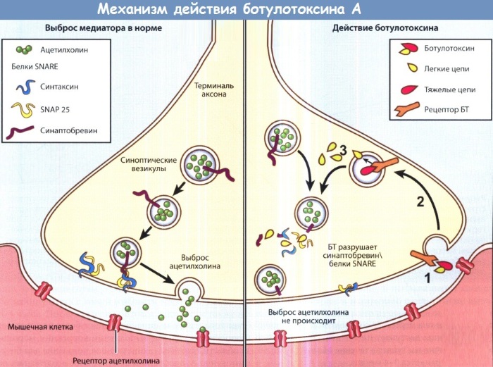 Асимметрия лица. Причины и лечение у взрослых, как исправить, физиогномика