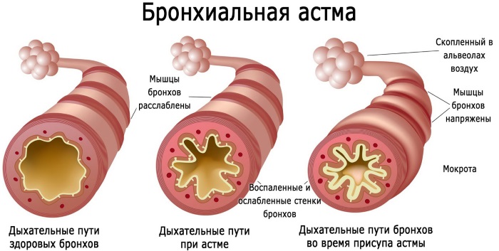 Фентанил. Инструкция по применению в ампулах, пластырь. Цена, аналоги